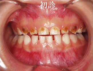 初診