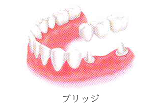 従来の治療法