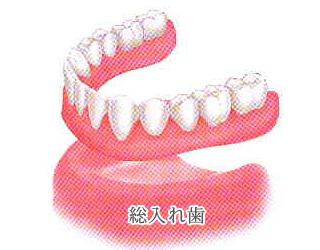従来の治療法