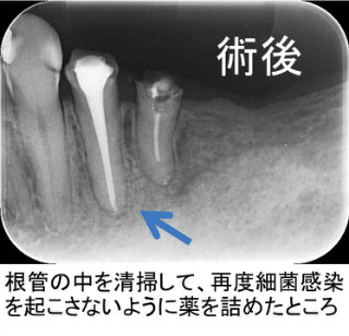 after