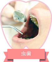 虫歯